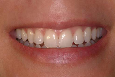 periodontal-cosmetic